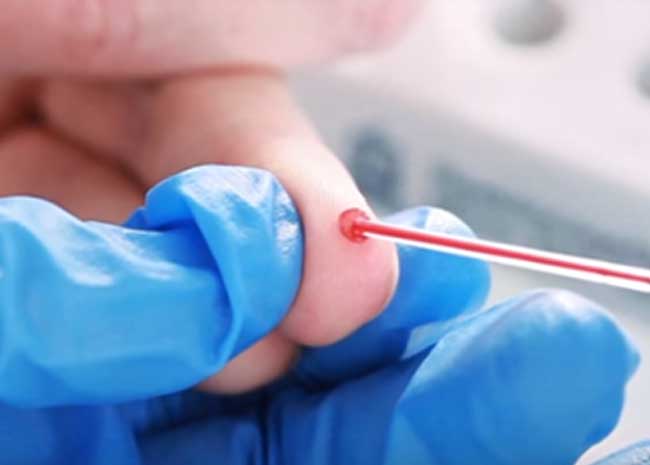 All-in-one 혈액 샘플링